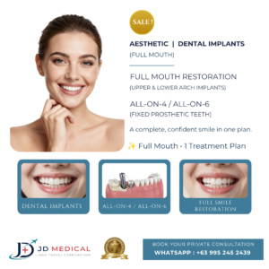 Dental Implant (Full Mouth)