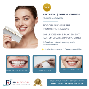 Smile Makeover (Dental Veneers)